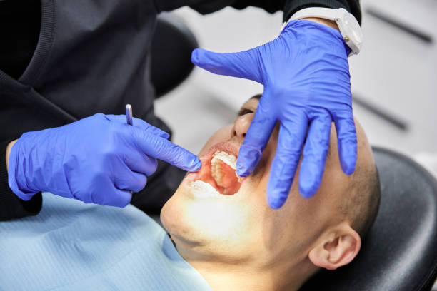 Best Cracked Tooth Emergency Dentist  in Los Ranchos, CA